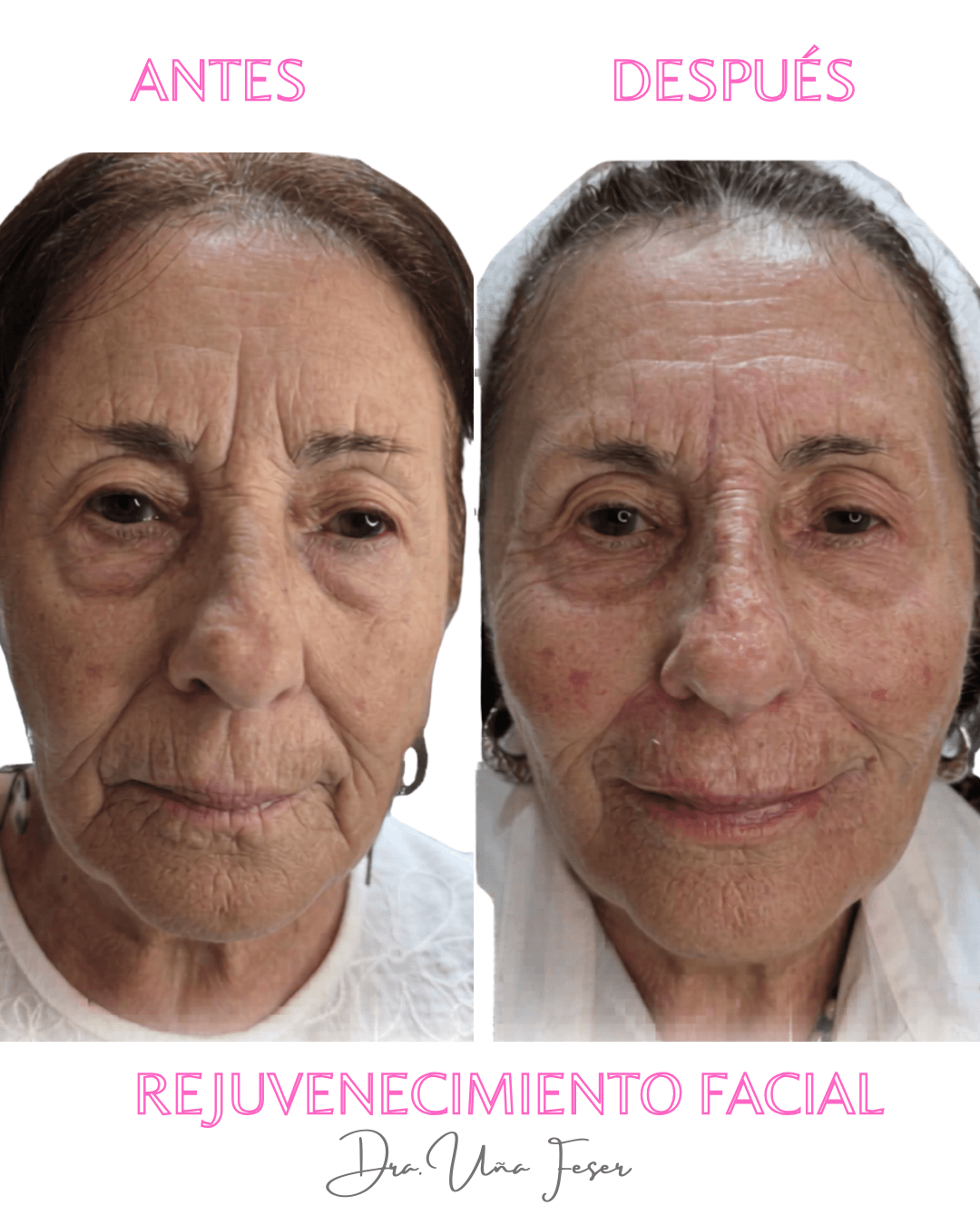 Paciente 3